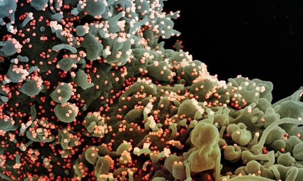 Ново огнище на коронавирус в област Пазарджик 12 работници