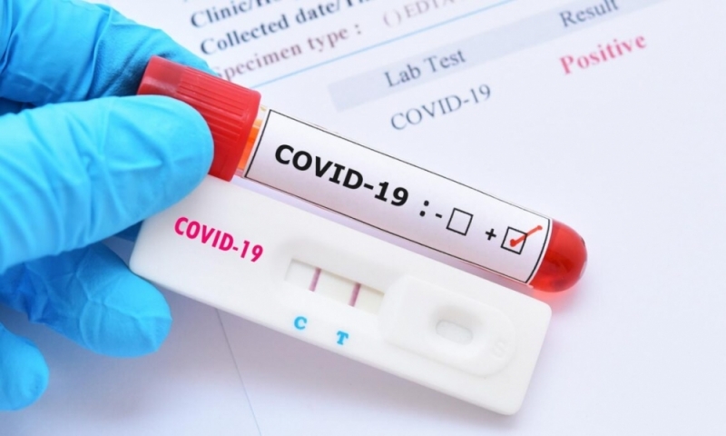 169 са новите потвърдени случаи на коронавирус в страната, сочат