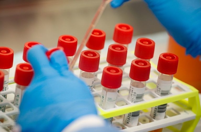 От Регионалната здравна инспекция в Монтана съобщиха подробности за разпространението