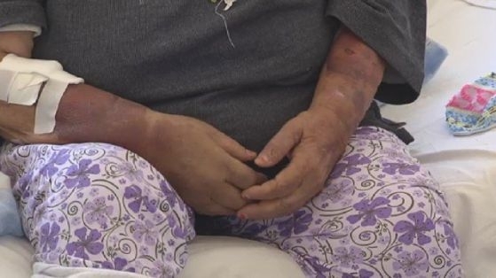 Млад мъж преби баба си в Перник съобщиха от полицията Сигнал за побоя