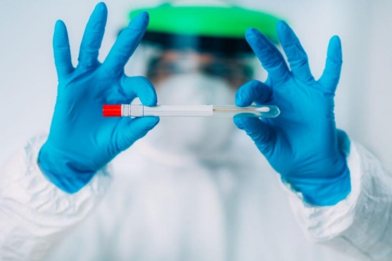 Нови 24 проби за наличие на коронавирус взеха във Врачанско