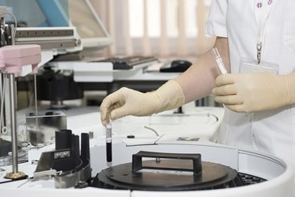 71 от случаите на хепатит А в ромската махала на