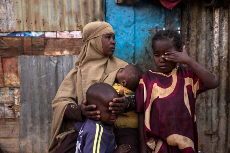 Десетки хиляди деца в Етиопия страдат от най смъртоносната форма на