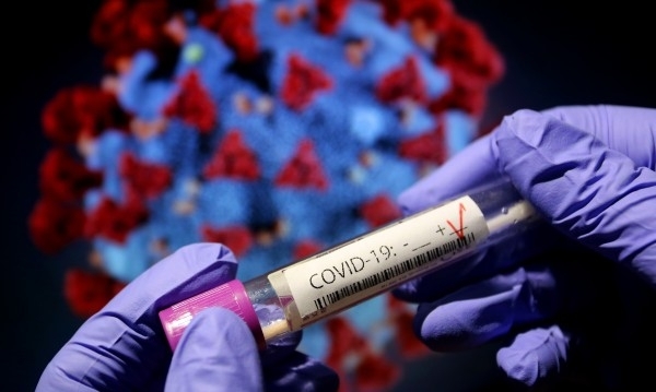 1002 са новодиагностицираните с коронавирусна инфекция лица през изминалите 24