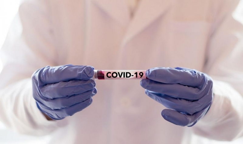 134 са новите случаи на COVID 19 у на след извършването