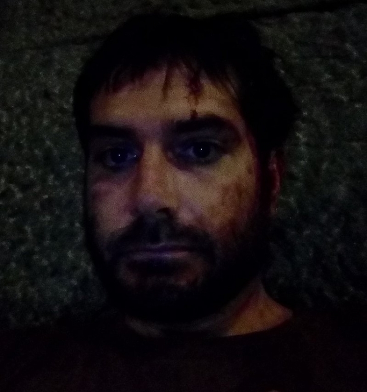 Журналистът Димитър Кенаров е бил брутално пребит на протеста в