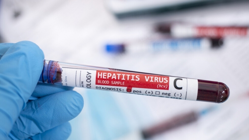 Две съмнителни проби за новия остър хепатит при децата се