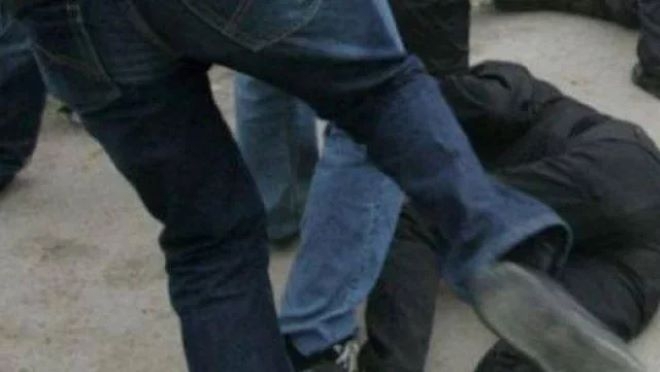 Пребиха дядо в Монтана при спор за паркомясто със счупени