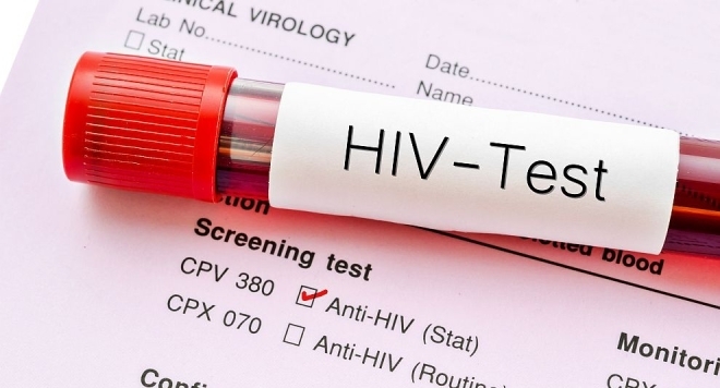 Учени са излекували пациент от вируса на ХИВ пише Ню Йорк