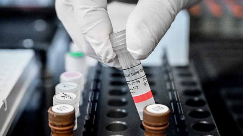 842 са новите случаи на коронавирус за изминалото денонощие показват