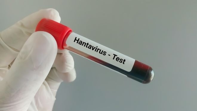 Пациент в Румъния е дал положителен тест за хантавирус
