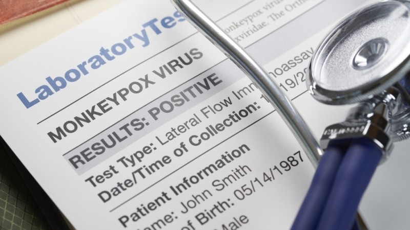 Испания и Бразилия обявиха първите смъртни случаи свързани с маймунската