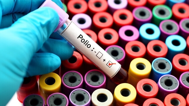 Медици диагностицираха първия случай на полиомиелит в щата Ню Йорк