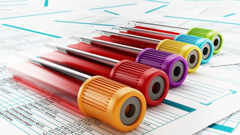 1465 проби са изследвани в страната за последните 24 часа