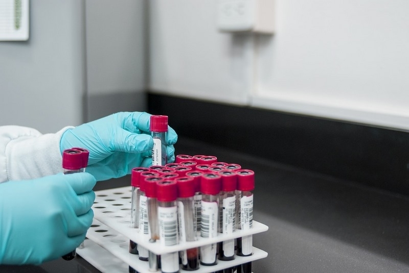 Нови 51 проби за коронавирус са взети за изминалия ден