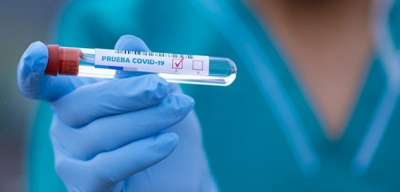 Само 44 са новодиагностицираните с коронавирусна инфекция лица за последното