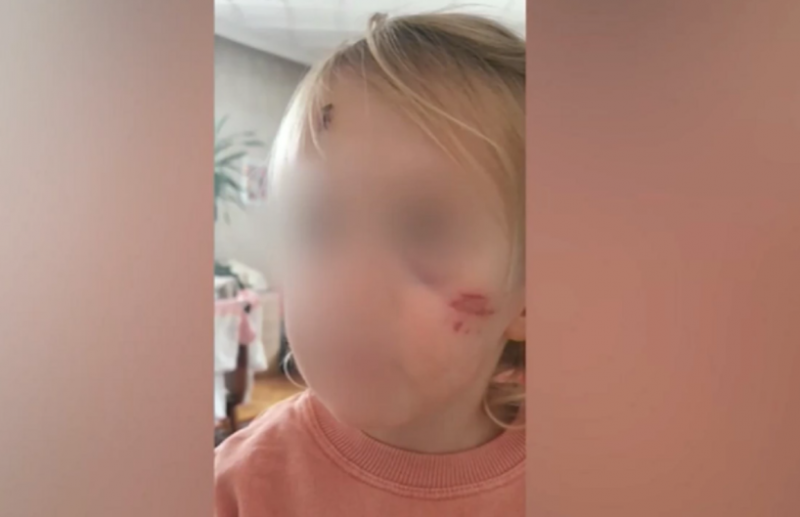 Дете пострада в такси след като майка му потърсила сметка