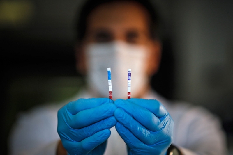 208 със 161 случая повече от вчера са новодиагностицираните с