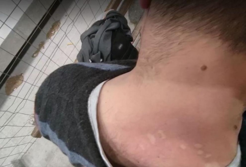 Дървеници нахапаха пътник във влака Горна Оряховица Димитровград Потърпевшият