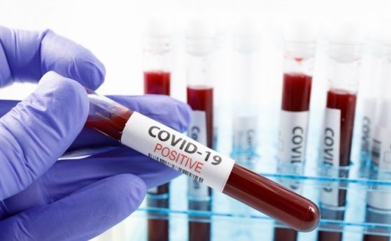 904 са новозаразените с коронавирус у нас през изминалите 24