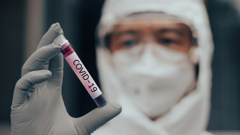 През последното денонощие у нас са регистрирани нови 136 заразени