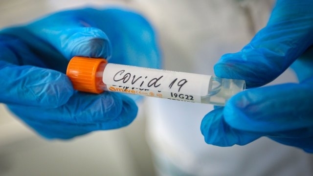 106 са новите случаи на COVID 19 у нас за последното