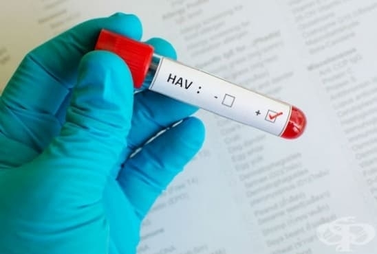 Епидемичен взрив от вирусен Хепатит А е регистриран на територията