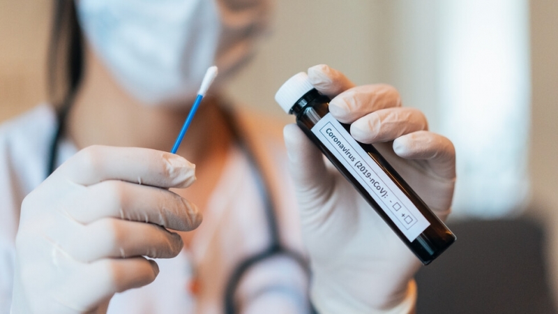 4616 са новодиагностицираните с COVID 19 лица у нас за изминалите