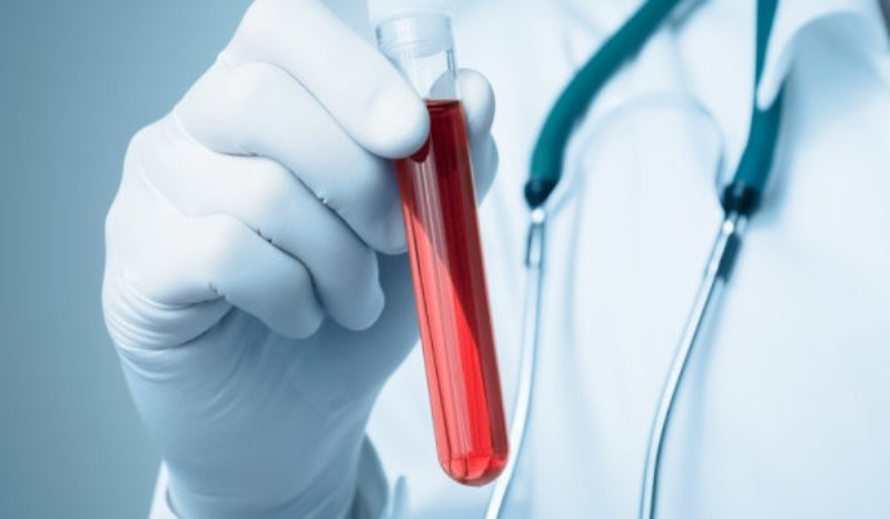 Поредна научна публикация намира връзка между кръвната група и риска