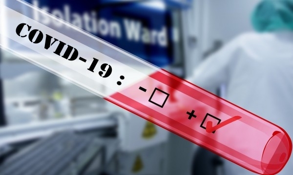 Новите случаи с коронавирус за последното денонощие у нас са