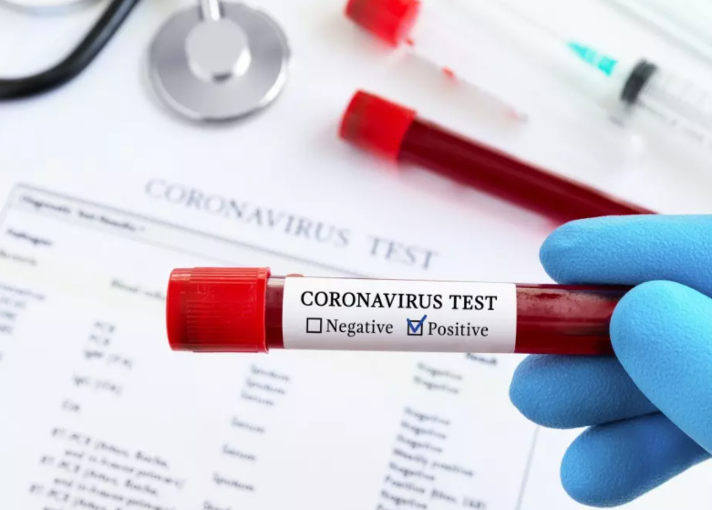 3183 са новодиагностицираните с COVID 19 лица у нас за изминалите