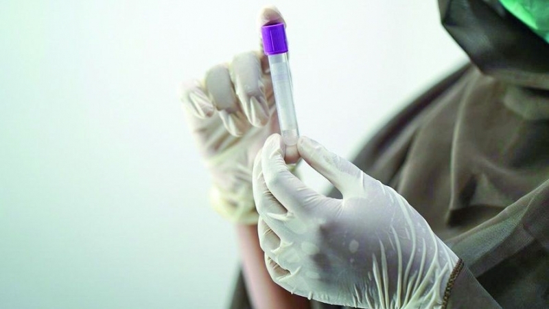 Маймунска шарка и хепатит сред децата атакуват света Първите регистрирани