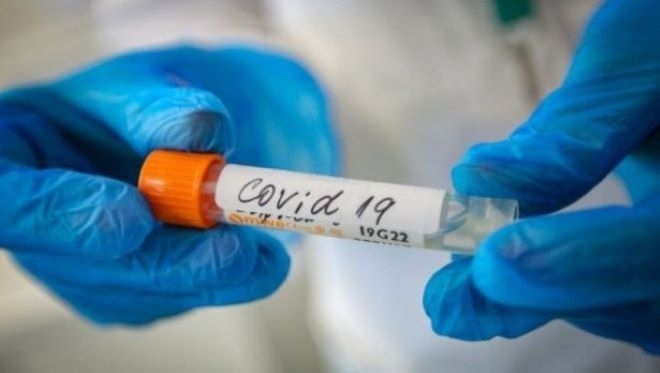 Осемдесет и седем нови случая на коронавирус са били регистрирани през последното
