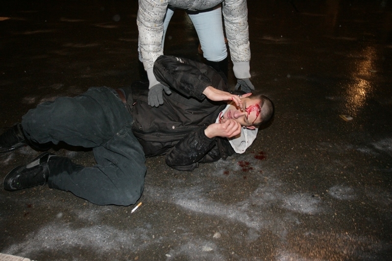 Четирима мъже са нападнали и пребили 20 годишен младеж от Сандански