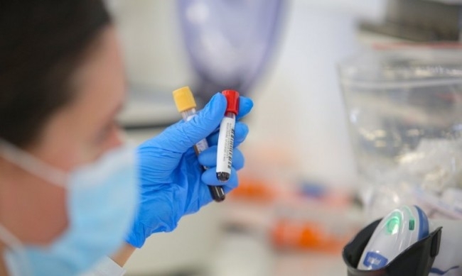 2018 са новозаразените с коронавирус за последните 24 часа 7 29