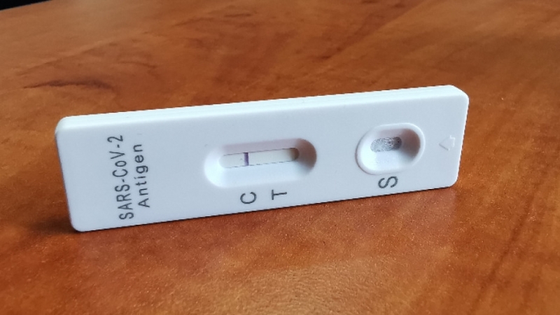 През следващия месец ще има доста болни от Омикрон Това каза