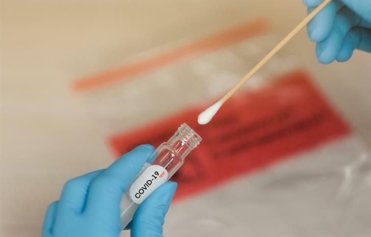 За последното денонощие са регистрирани 5 нови случая на коронавирус