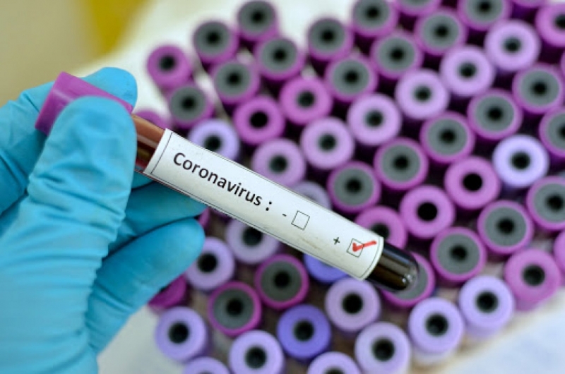 Шейсет и един нови случая на коронавирус са били регистрирани