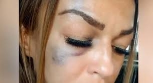 Съпрузи пребиха и ограбиха жена в ботевградско село съобщиха от полицията На