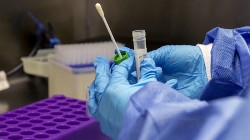 3146 с 2023 повече от вчера са новодиагностицираните с коронавирусна