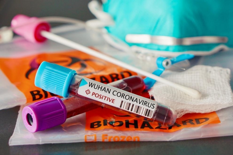 Нови 13 проби за коронавирус са взети на територията на