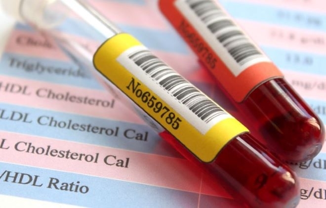 Всеки човек трябва да провери нивата на холестерол в кръвта