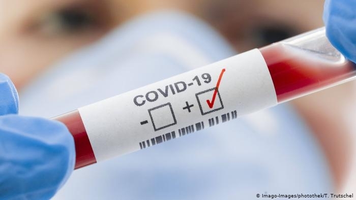 30 са новите потвърдени случаи на коронавирус у нас за