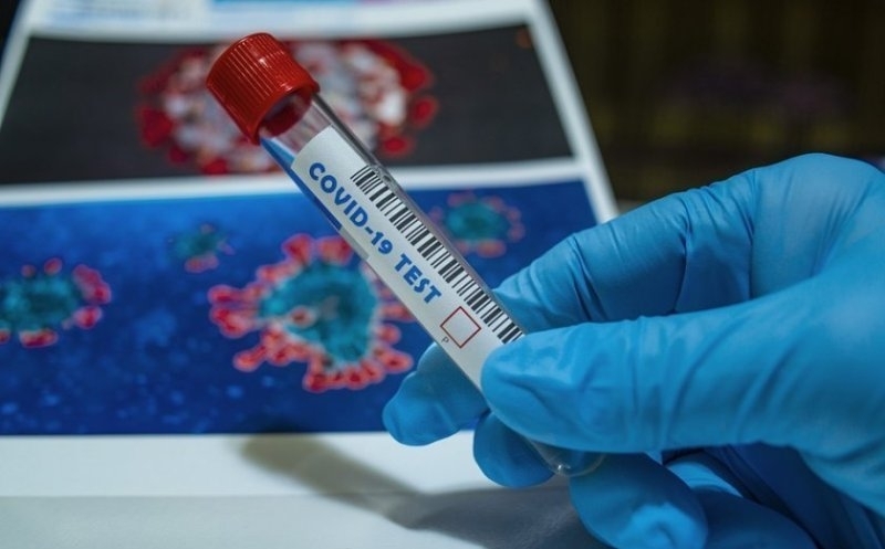 Още 308 българи са с ковид от петък показват данните