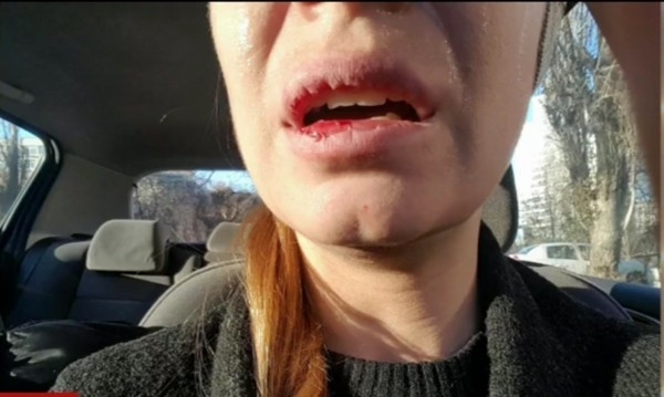 Друга версия за битата шофьорка която разказа вчера за премеждията