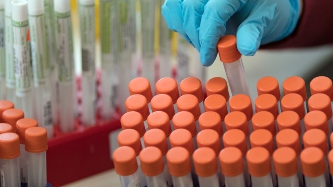 За последното денонощие са установени 22 нови случая на коронавирус