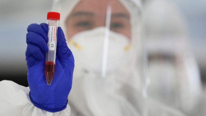 По данни на РЗИ Видин още 4 лица от