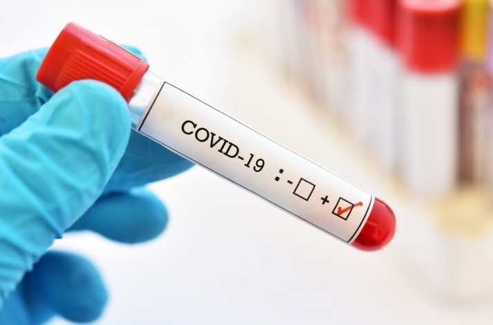 332 със 747 случая по малко от вчера са новодиагностицираните с