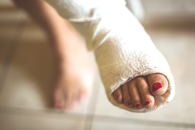 57 годишна жена е със счупен крак след семеен скандал в