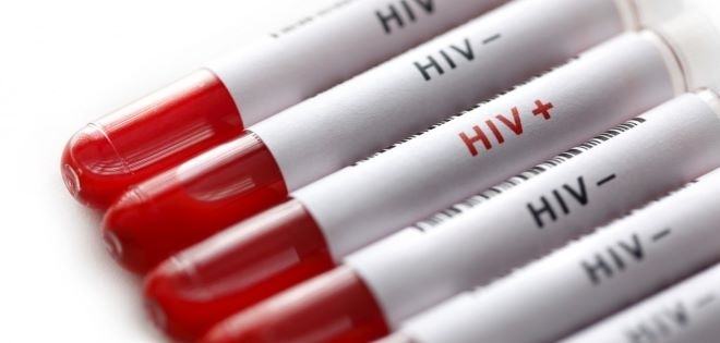 Здравната инспекция в Монтана регистрира пациент с ХИВ инфекция научи BulNews Случаят е първи